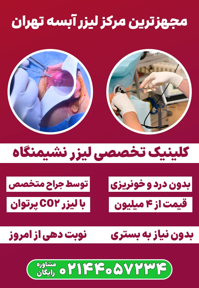 لیزر آبسه مقعدی